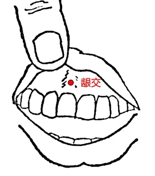 齦交穴.jpg